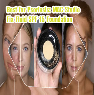 Best makeup for redness