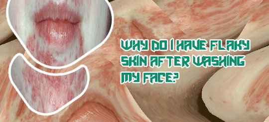 Flaky skin on face