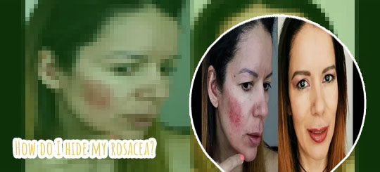 Rosacea friendly makeup
